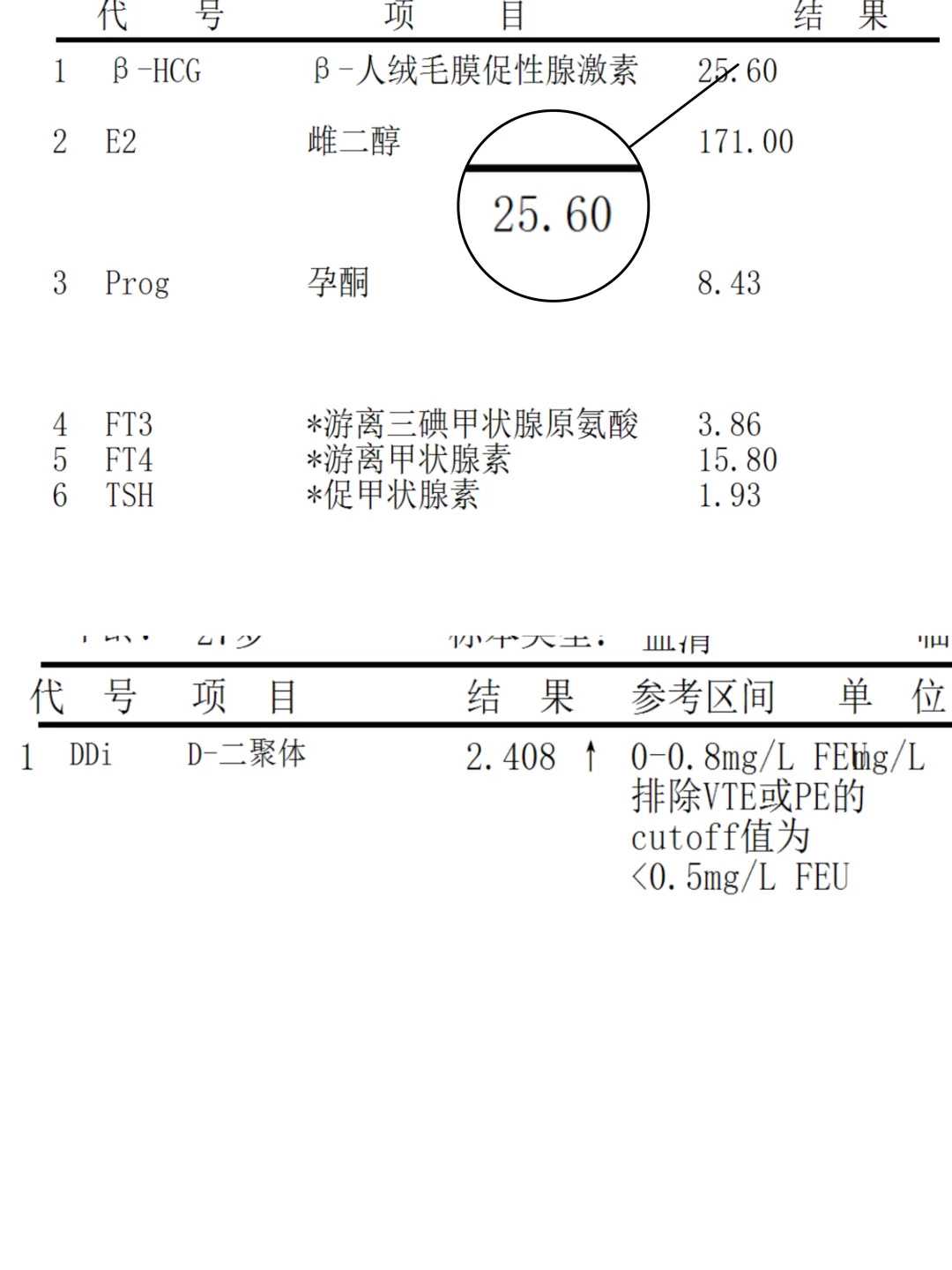代孕儿子医院,卵巢早衰做试管一般几次才能成功？这几点也可能拉成功率的后