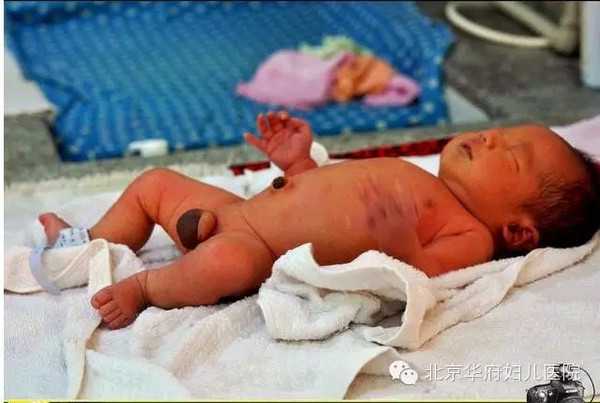 广州有哪些代妈的资料：【广州输通输卵管要多
