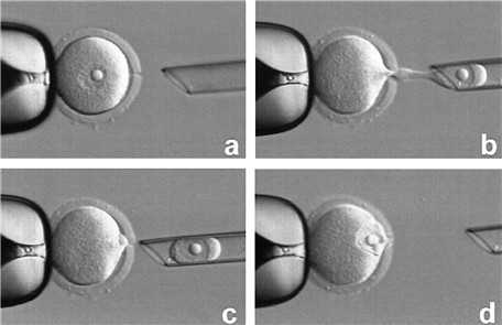 检查输卵管通不通的方法