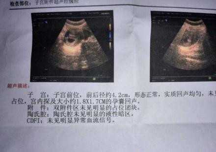 南京代孕-南京代孕电话多少-南京代孕哪里成功率