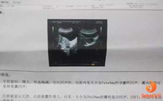 南京医院哪家供卵好,【南京哪个医院供卵好】37+3周，生产狗年宝宝，分享一下